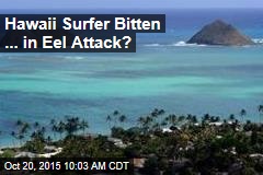 Hawaii Surfer Bitten ... in Eel Attack?