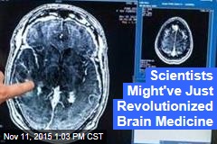 Scientists Might&#39;ve Just Revolutionized Brain Medicine