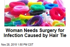 Woman Needs Surgery for Infection Caused by Hair Tie