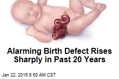 Alarming Birth Defect Rises Sharply in Past 20 Years