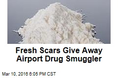 Fresh Scars Give Away Airport Drug Smuggler