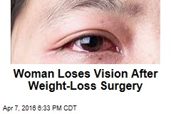 Woman Loses Vision After Weight-Loss Surgery