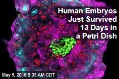 Human Embryos Just Survived 13 Days in a Petri Dish