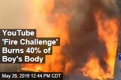 YouTube &#39;Fire Challenge&#39; Burns 40% of Boy&#39;s Body