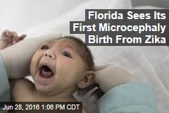 Florida Sees Its First Microcephaly Birth From Zika