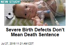 Severe Birth Defects Don&#39;t Mean Death Sentence