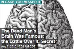 The Dead Man&#39;s Brain Was Famous, the Battle Over It, Secret