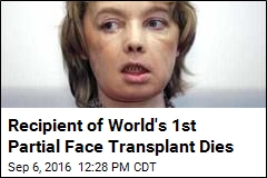 Recipient of World&#39;s 1st Partial Face Transplant Dies