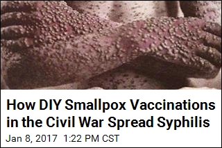 How DIY Smallpox Vaccinations in the Civil War Spread Syphilis