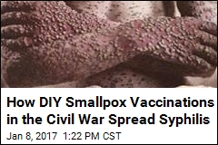 How DIY Smallpox Vaccinations in the Civil War Spread Syphilis