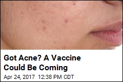Acne Fighters Say Vaccine May Be on the Horizon