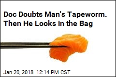 Doc Doubts Man&#39;s Tapeworm. Then He Looks in the Bag