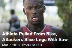 Triathlete Biking to Practice Has Legs Sliced With Saw