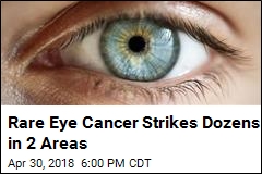 Medical Mystery: 2 Apparent Clusters of Rare Eye Cancer