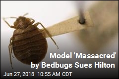 Model &#39;Massacred&#39; by Bedbugs Sues Hilton