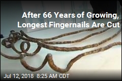After 66 Years of Growing, Longest Fingernails Are Cut