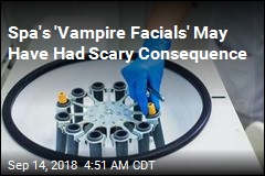 &#39;Vampire Facials&#39; May Have Exposed People to HIV