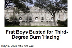 Frat Boys Busted for Third-Degree Burn 'Hazing'
