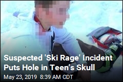 Suspected &#39;Ski Rage&#39; Incident Puts Hole in Teen&#39;s Skull