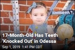17-Month-Old Has Teeth &#39;Knocked Out&#39; in Odessa