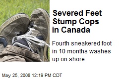 Severed Feet Stump Cops in Canada