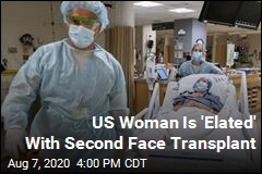 US Woman Is &#39;Elated&#39; With Second Face Transplant