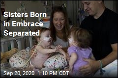 Conjoined Twins Home After Surgery