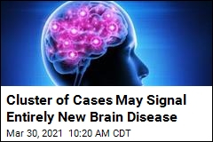 Cluster of Brain Ailments in Canada Stumps Doctors