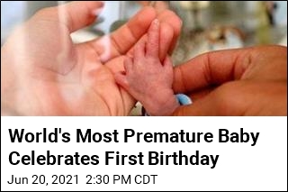 World&#39;s Most Premature Baby Celebrates First Birthday