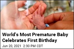 World&#39;s Most Premature Baby Celebrates First Birthday