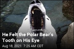 He Felt the Polar Bear&#39;s Tooth on His Eye