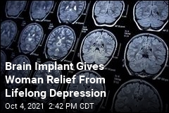 Brain Implant Gives Woman Relief From Lifelong Depression