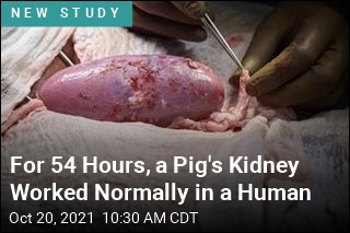 This Kidney Came From a Pig, and Worked in a Human