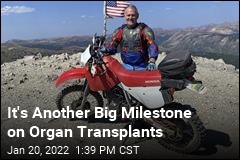 It&#39;s Another Big Milestone on Organ Transplants