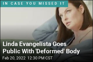 Linda Evangelista Goes Public With &#39;Deformed&#39; Body