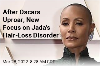 After Oscars Uproar, New Focus on Jada&#39;s Hair-Loss Disorder