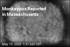 Monkeypox Reported in Massachusetts