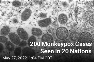 200 Monkeypox Cases Seen in 20 Nations