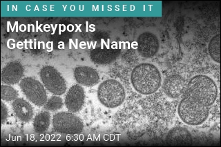 Monkeypox Is Getting a New Name
