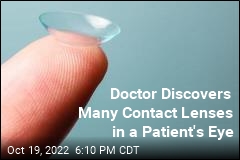 Doctor Discovers Many Contact Lenses in a Patient&#39;s Eye