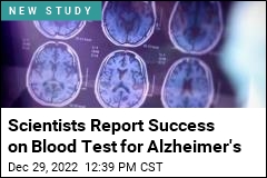 New Blood Test May Make It Easier to Detect Alzheimer&#39;s