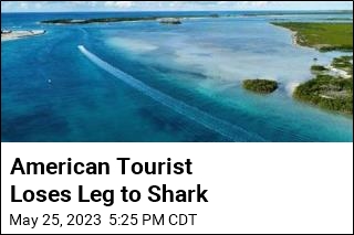 American Tourist Loses Leg to Shark