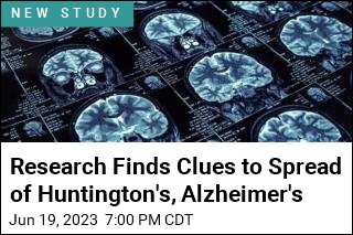 Researchers Make Find on How to Stop Spread of Huntington&#39;s