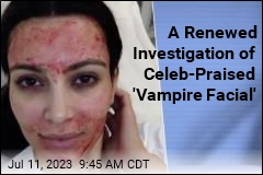 New Mexico Spa&#39;s &#39;Vampire Facial&#39; Tied to New HIV Case