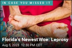 Florida&#39;s Newest Woe: Leprosy