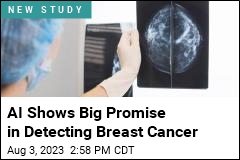 AI Reads Mammograms as Well as Human Radiologists