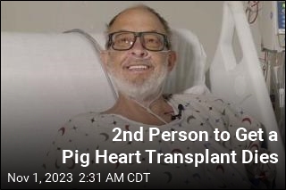Recipient of 2nd Pig Heart Transplant Dies