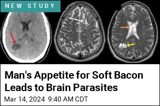 Man&#39;s Appetite for Soft Bacon Leads to Attack on His Brain