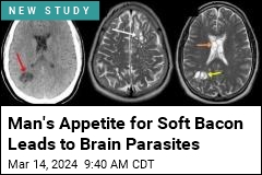 Man's Appetite for Soft Bacon Leads to Attack on His Brain