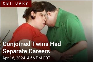 Oldest Conjoined Twins Die at 62